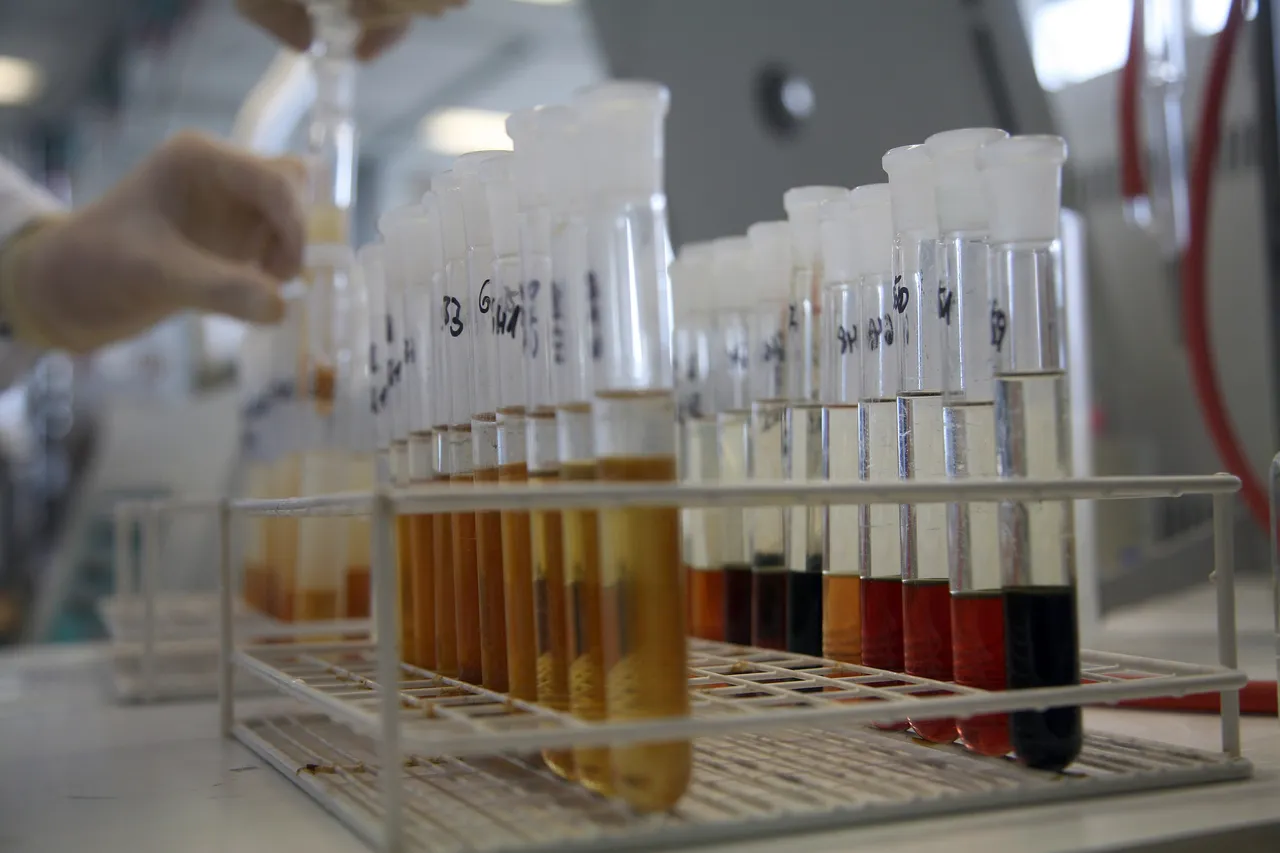doping test