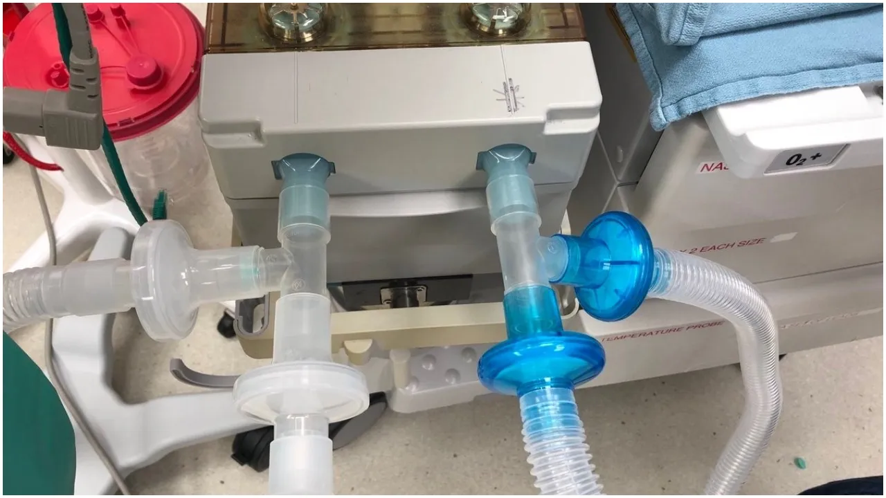 Ventilator