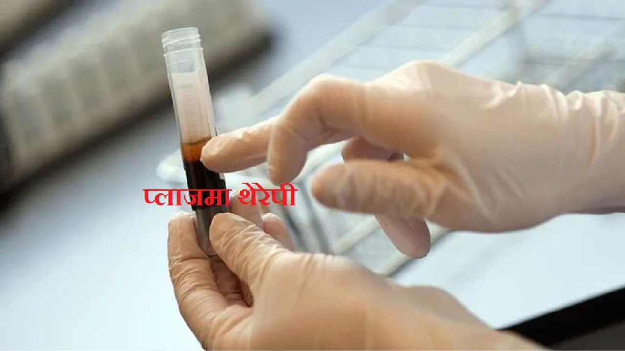 plasma therapy
