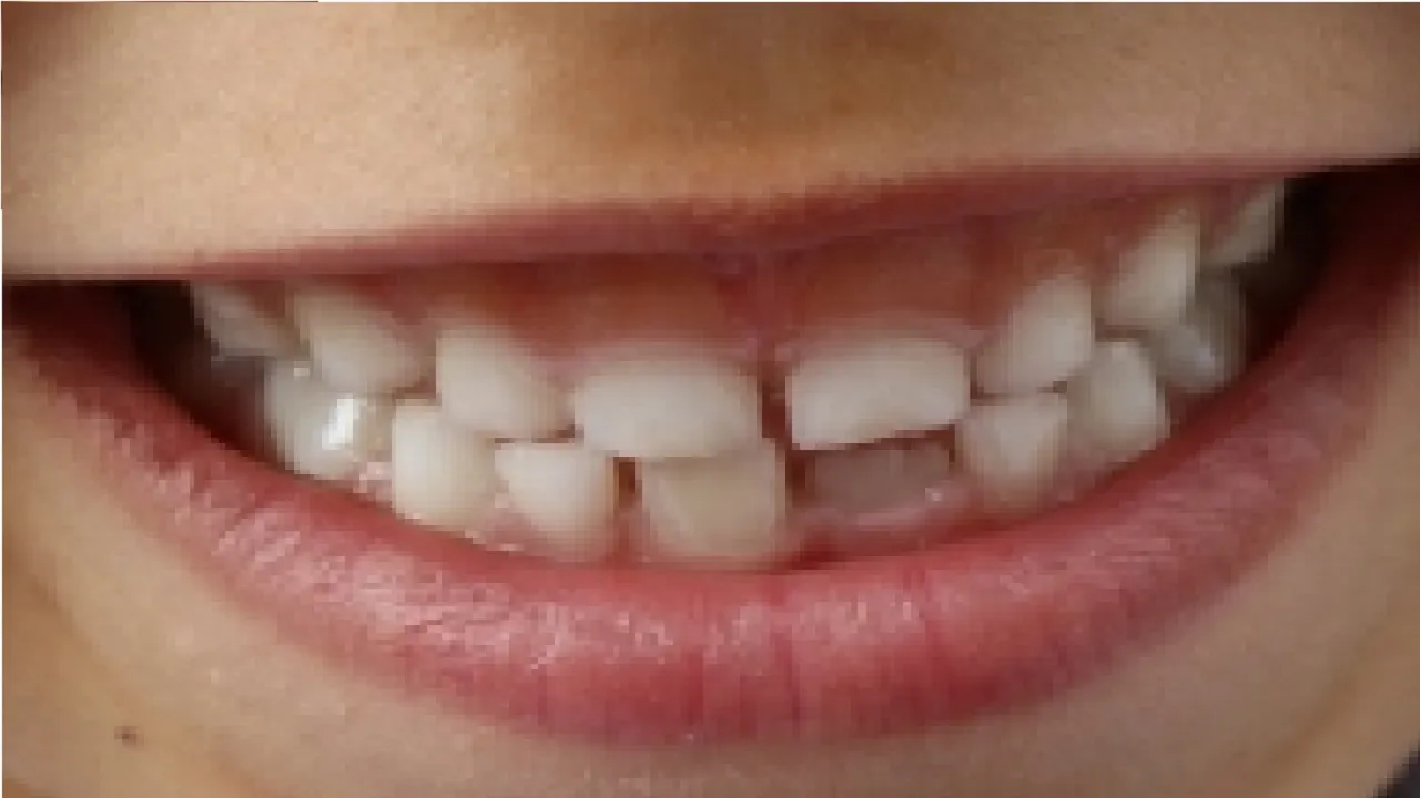 Teeth