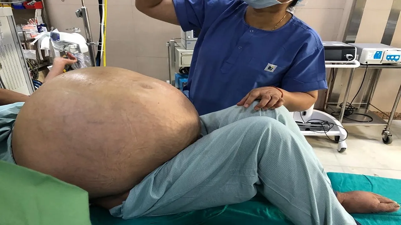 50 kg  tumer