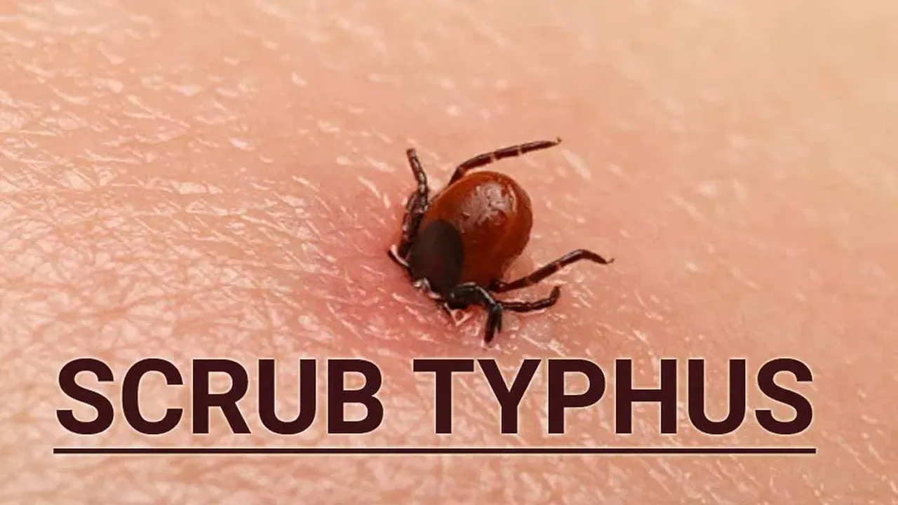 scrub typhus