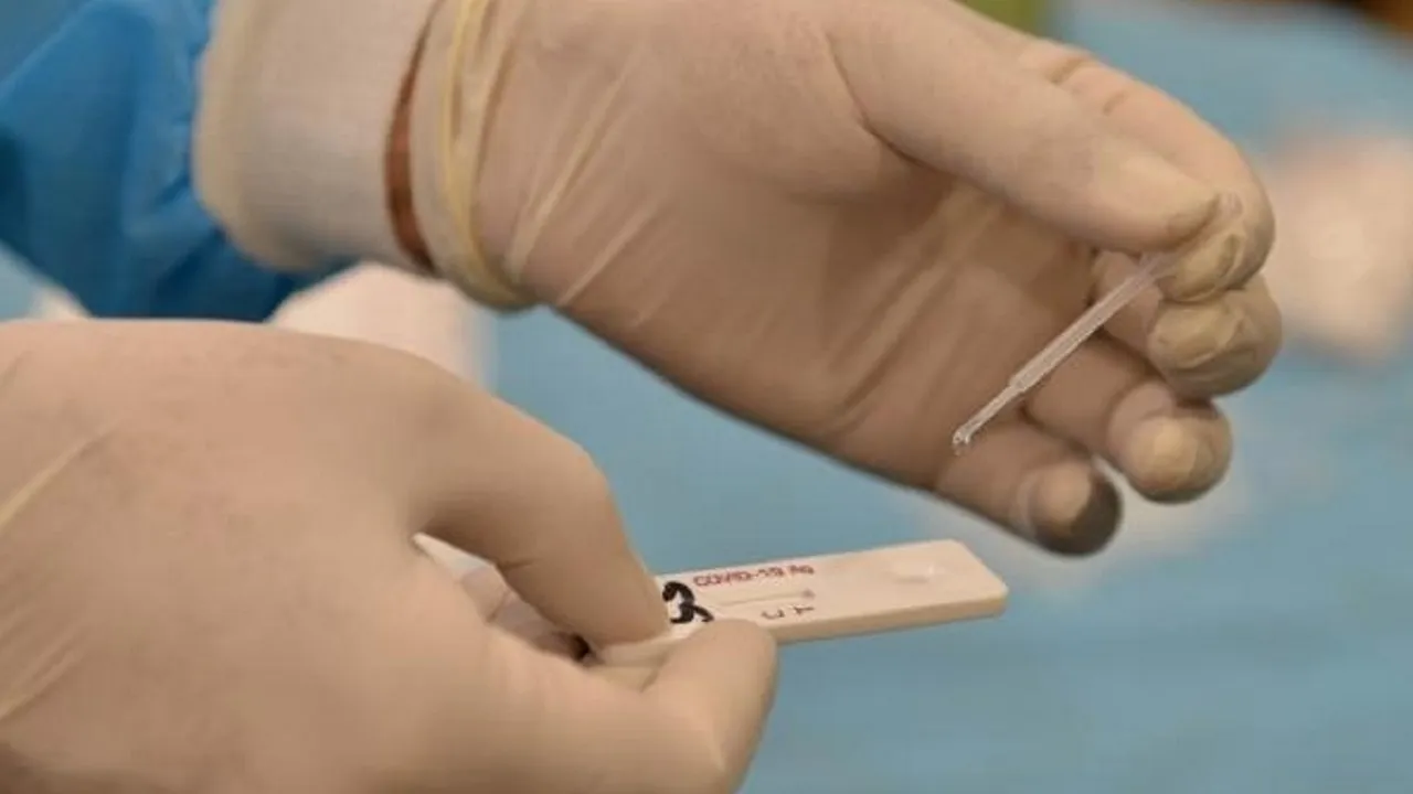 rt pcr test