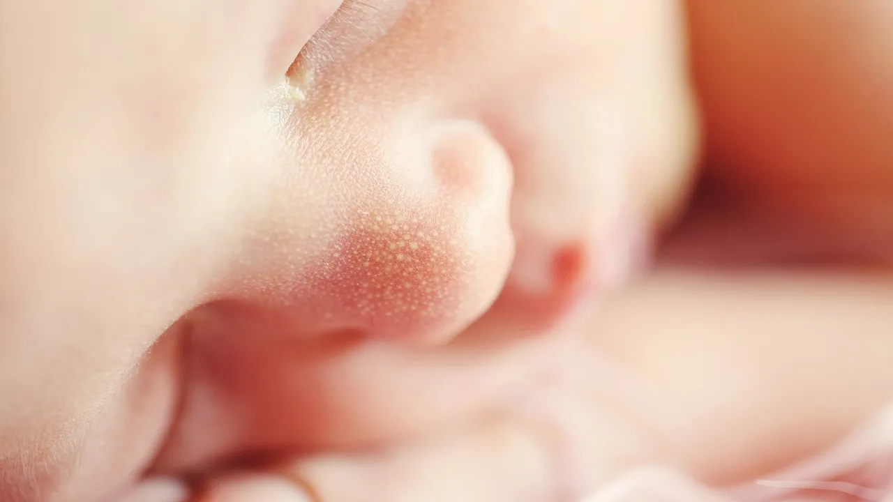Newborn with black fungus infection