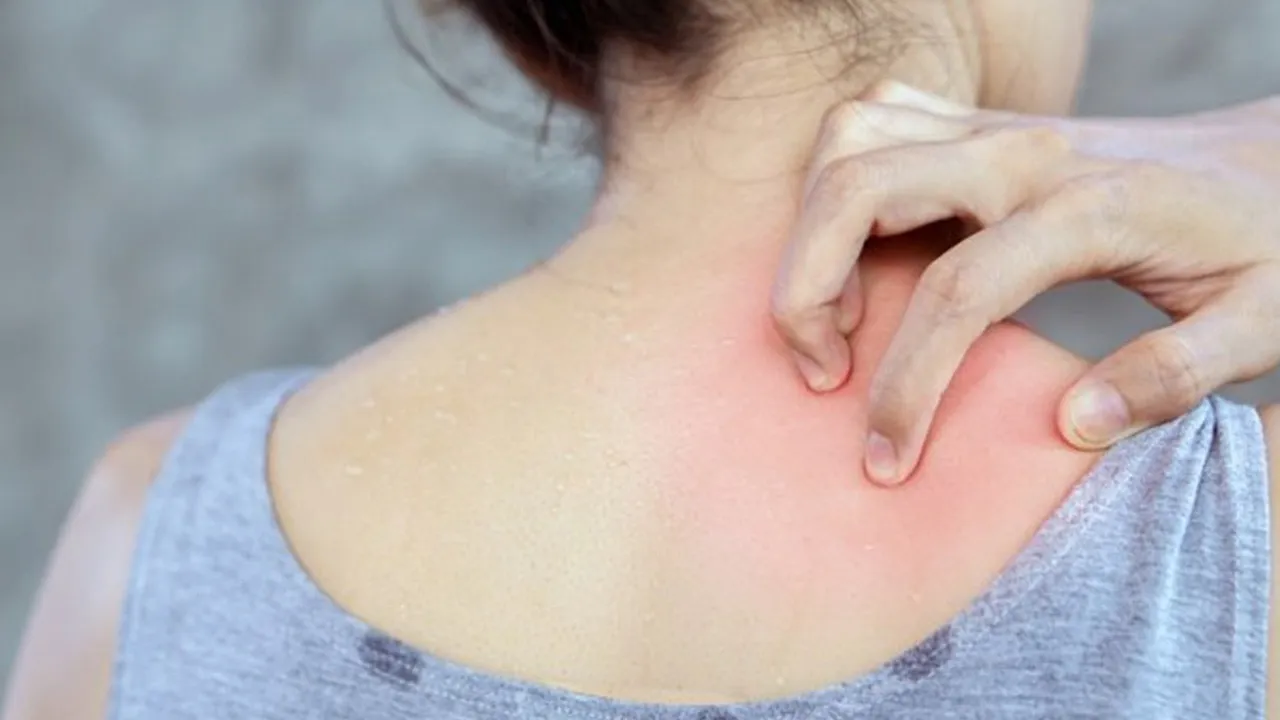 Skin Problems
