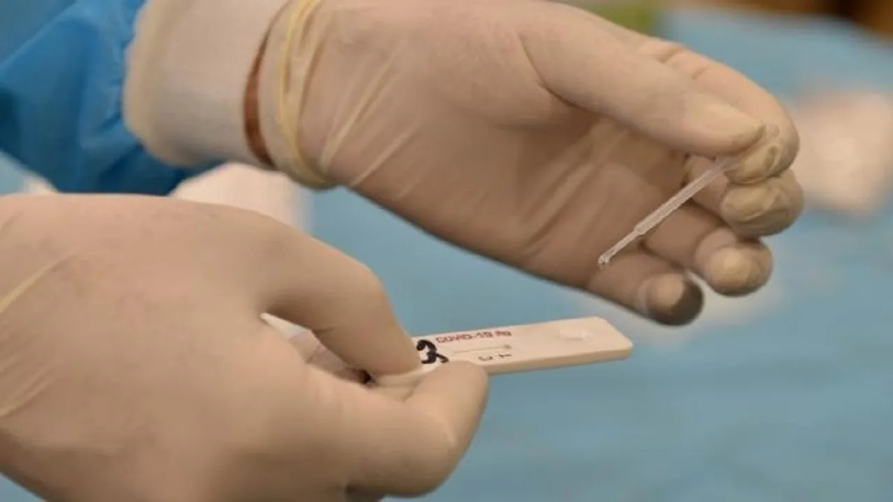 RT PCR Test