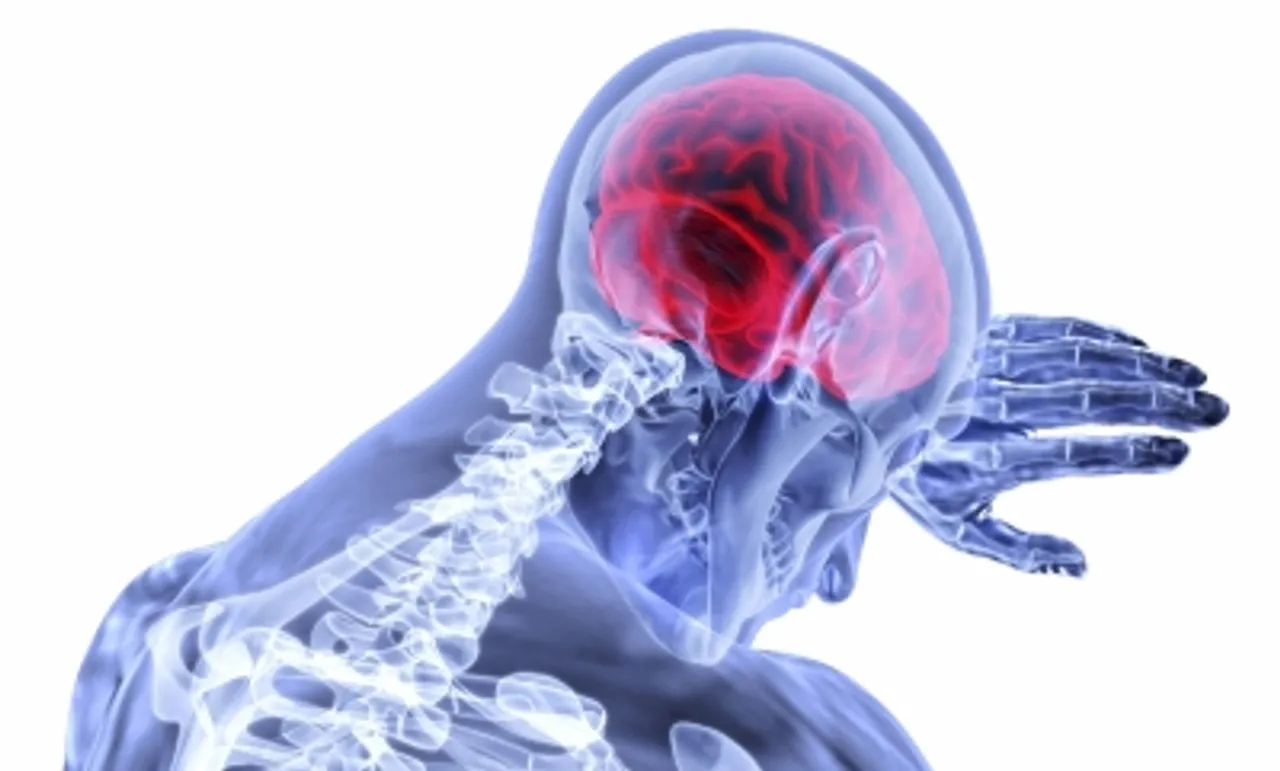 Brain troke
