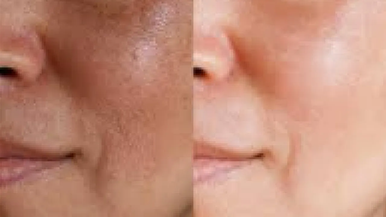 Glowing Skin and Dead Skin