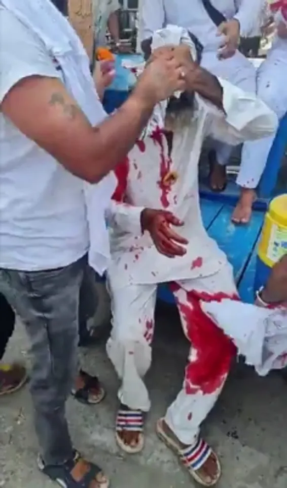Farmer injured