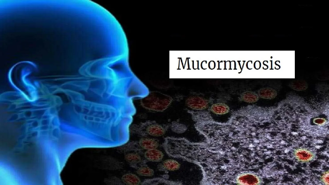 Mucormycosis