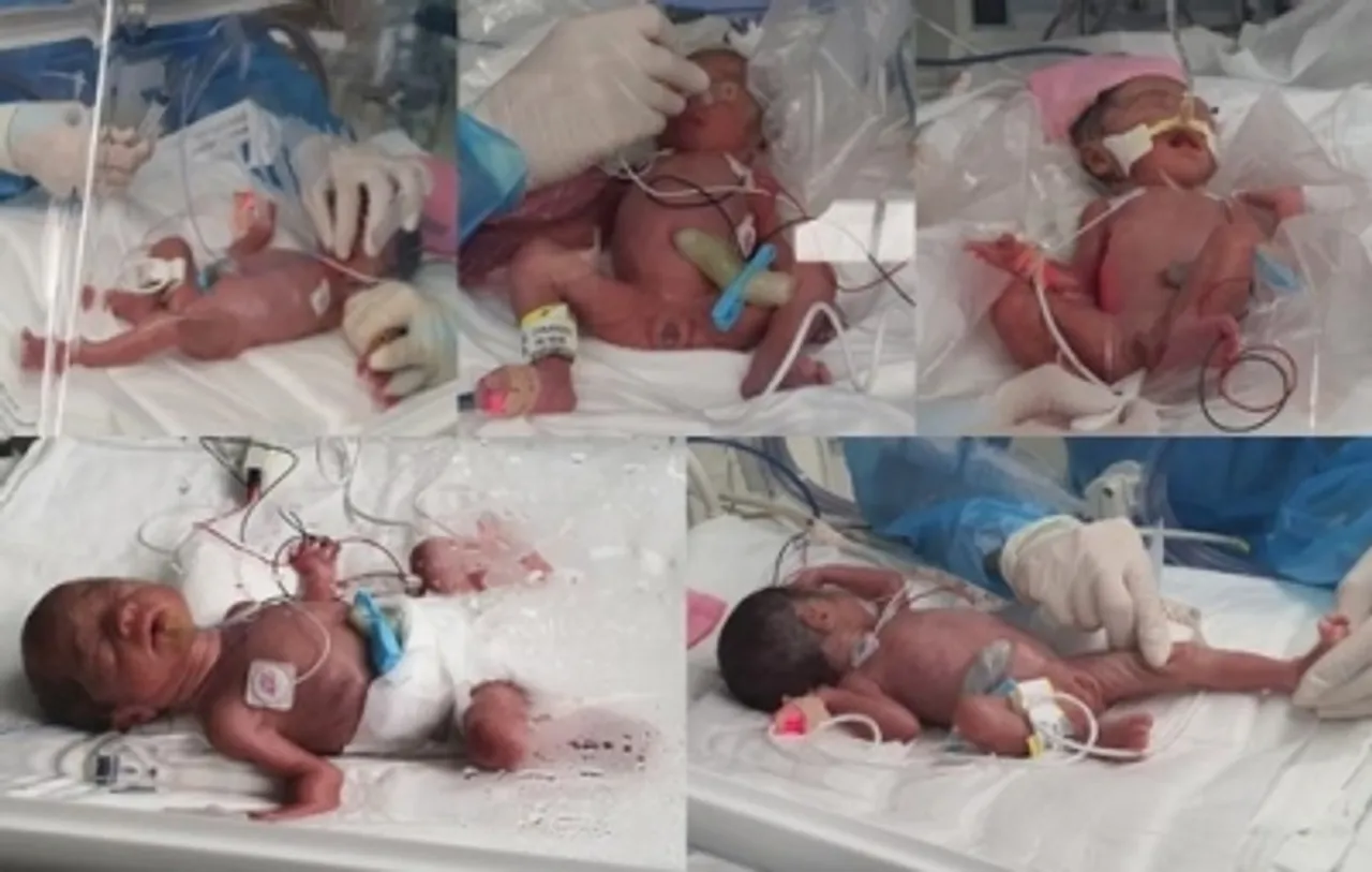 Quintuplet born