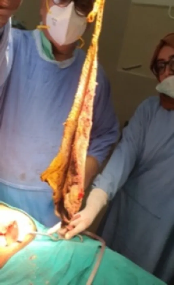 Three patient