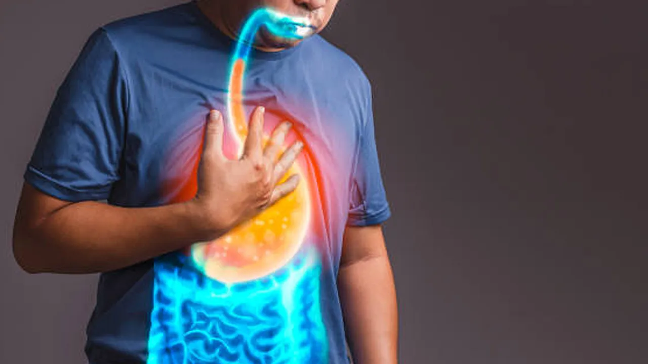 heartburn treatment