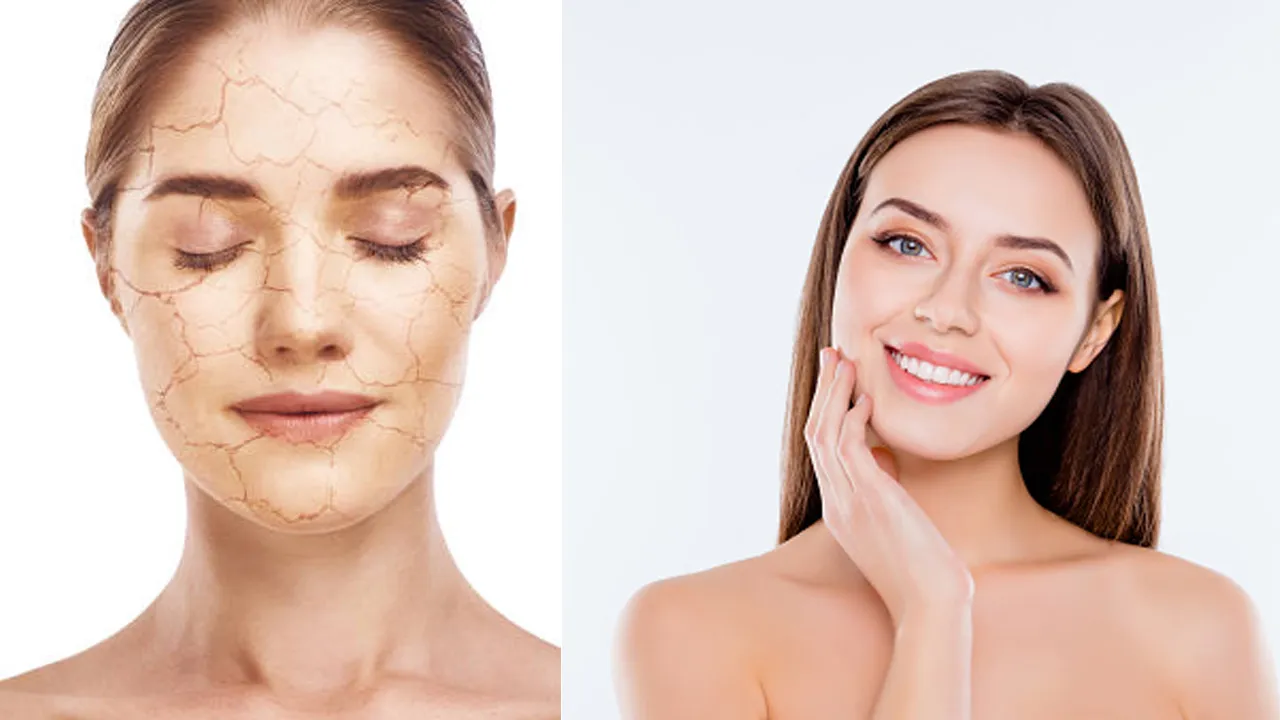Dry Face Treatment
