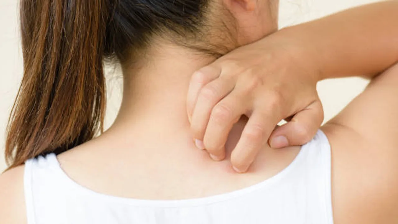 Ringworm Treatment