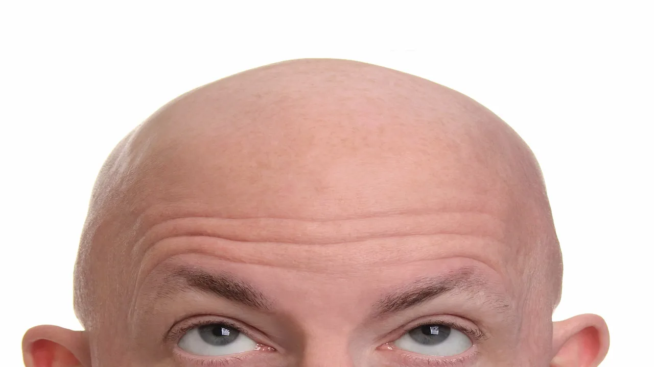 bald