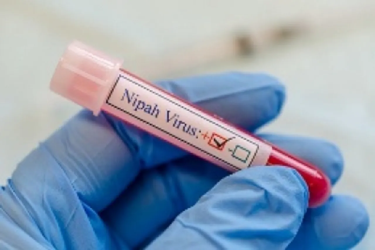 Nipah viru