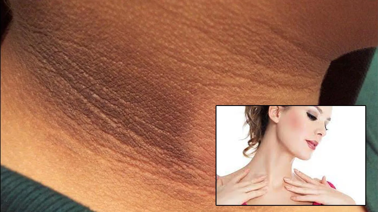 neck
