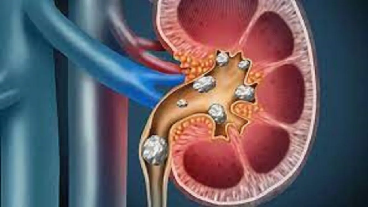 kidney