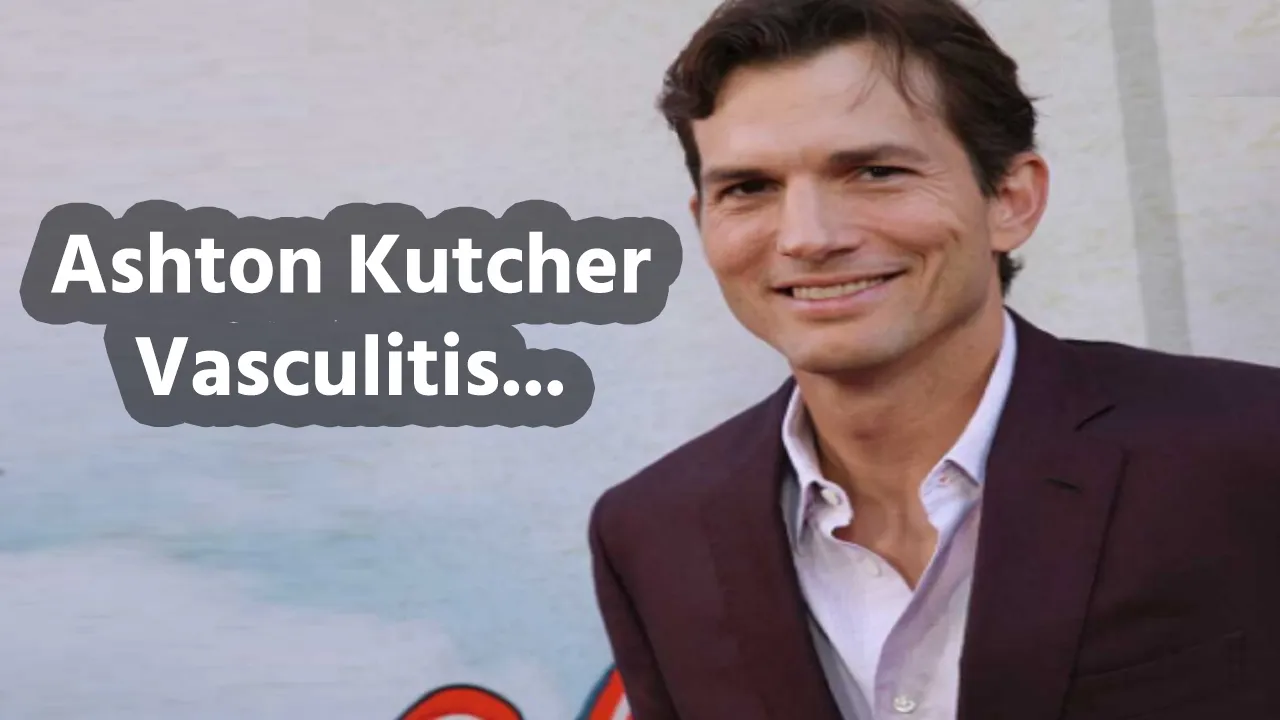 Ashton Kutcher