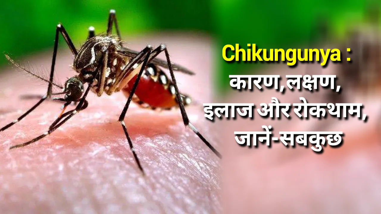 chikunguniya