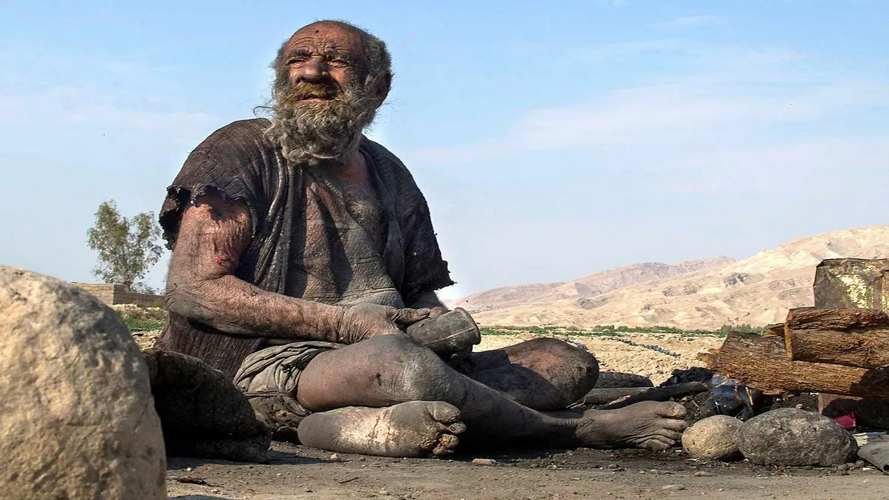 World s Dirtiest Man Died