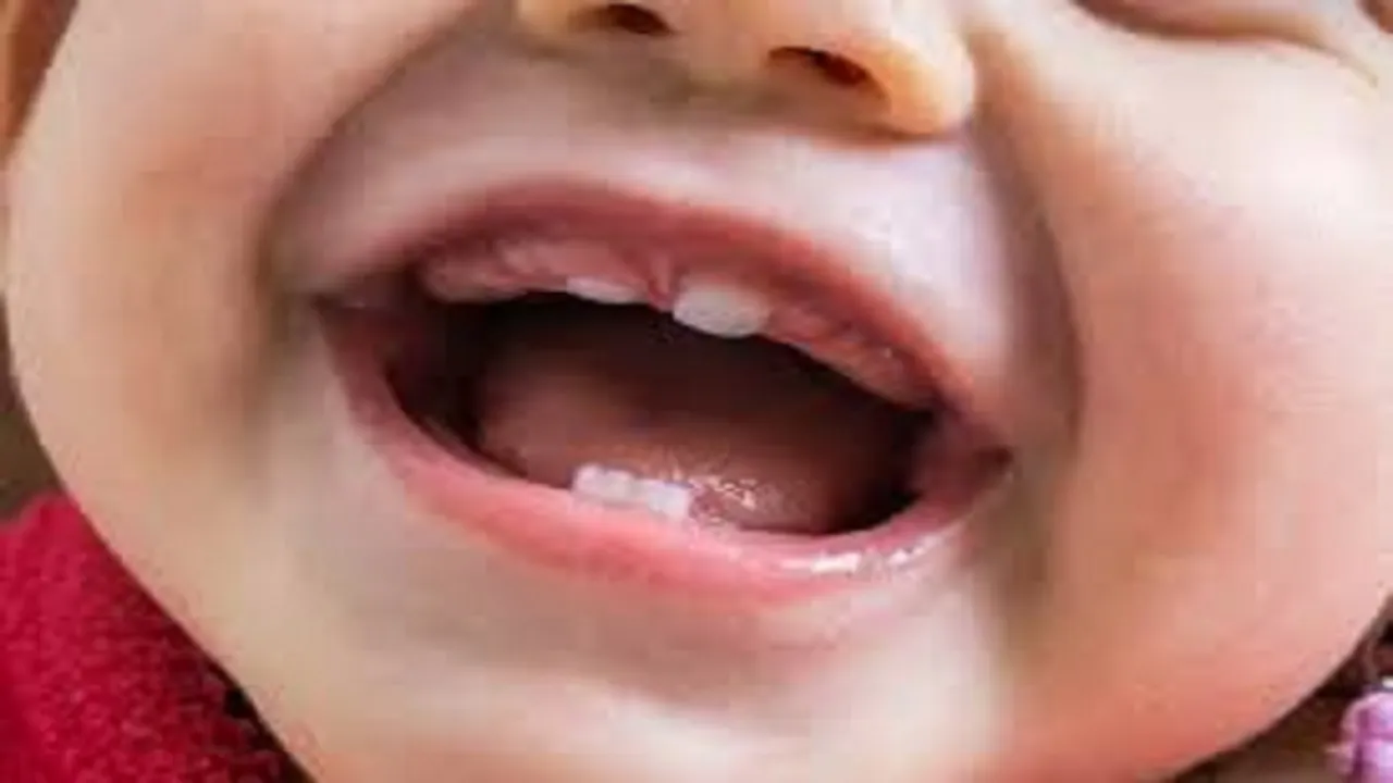 children teeth
