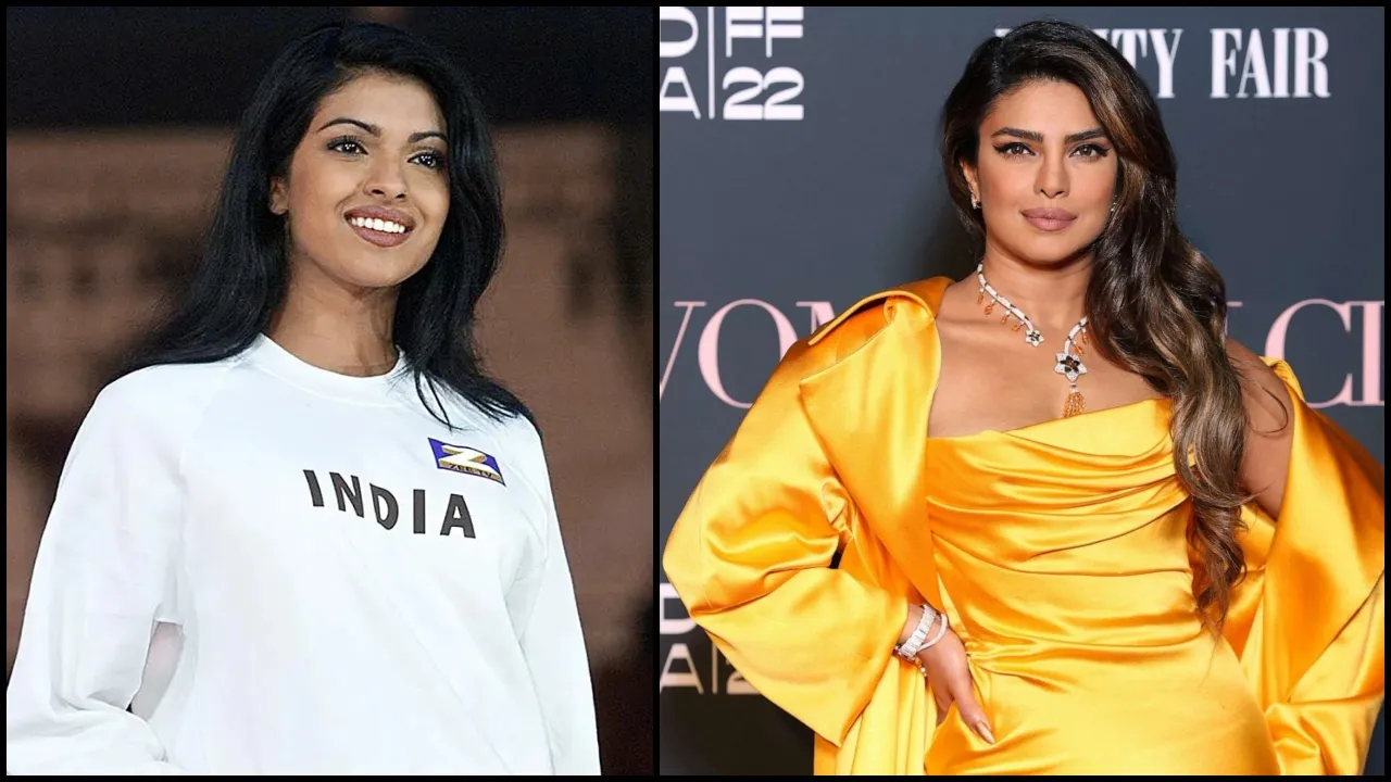 Priyanka Chopra NOSE SURGERY