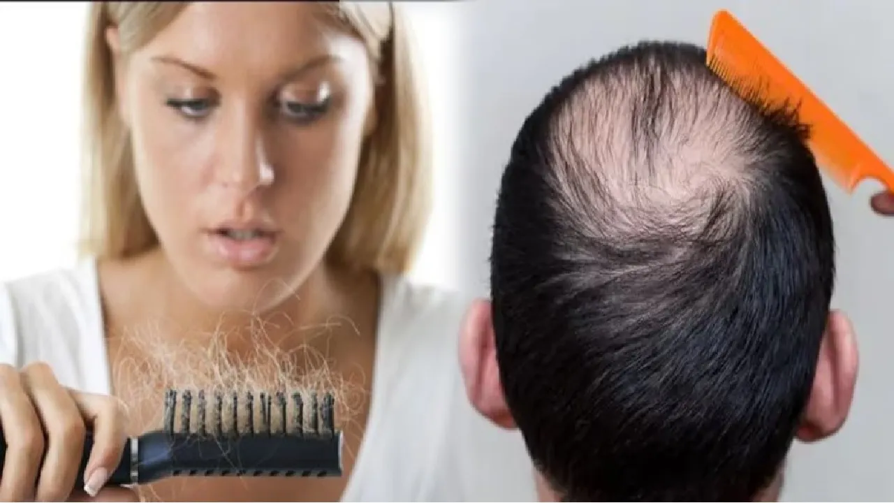HAIRFALL