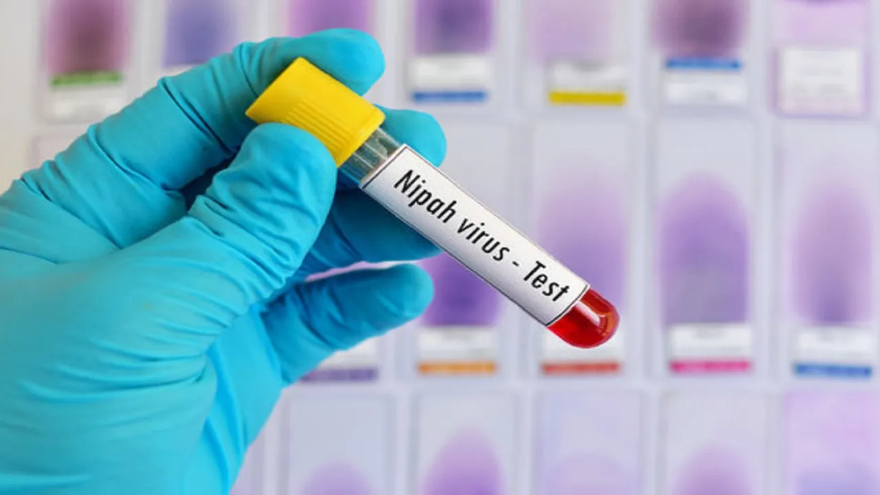 Nipah Virus