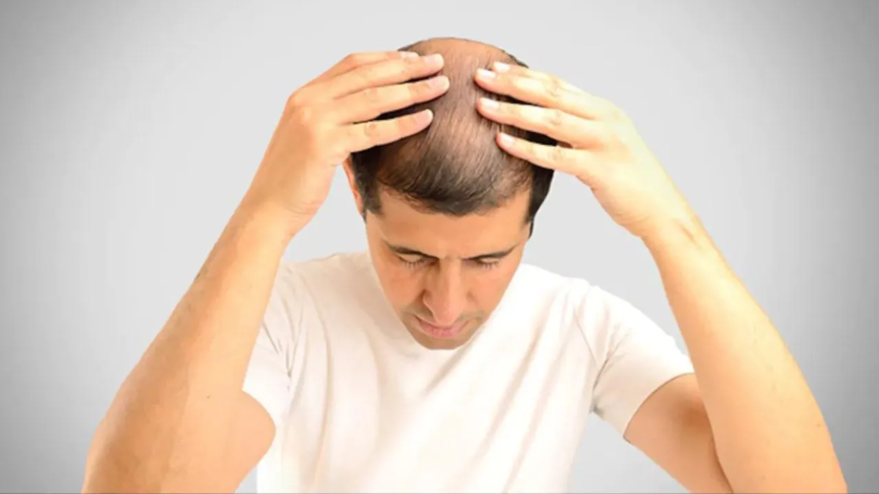 hair-loss-cancer