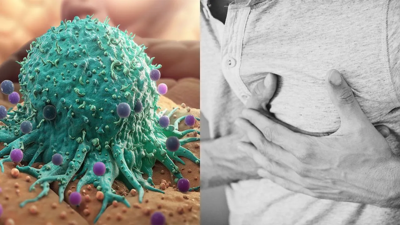 breast-cancer