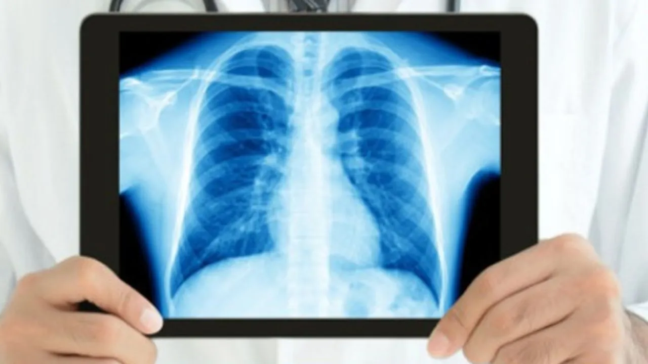 Radiography