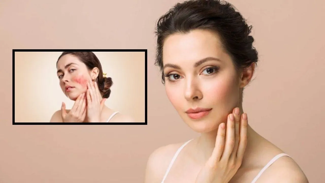 Skin care tips in winter season
