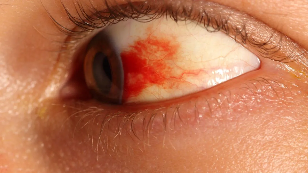 Woman Eye