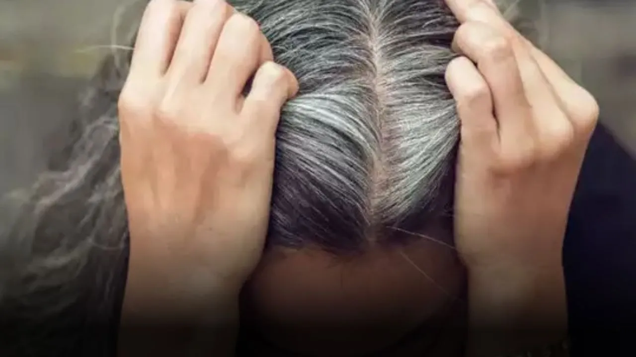 why hair turns white