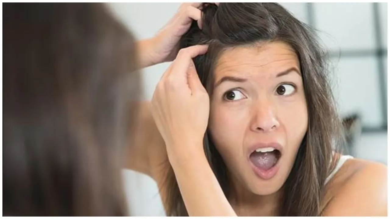 Premature greying of hair