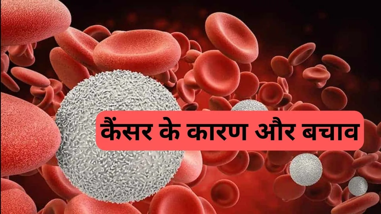What is the Causes of Cancer
