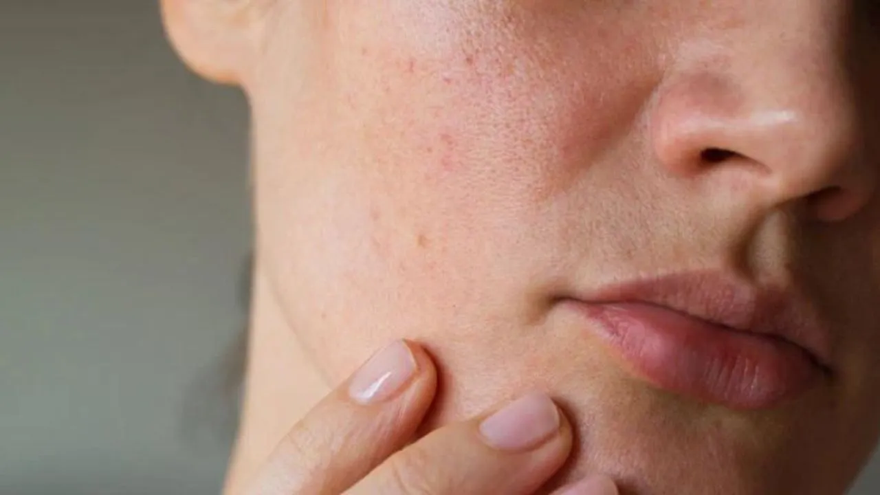 skin diseases
