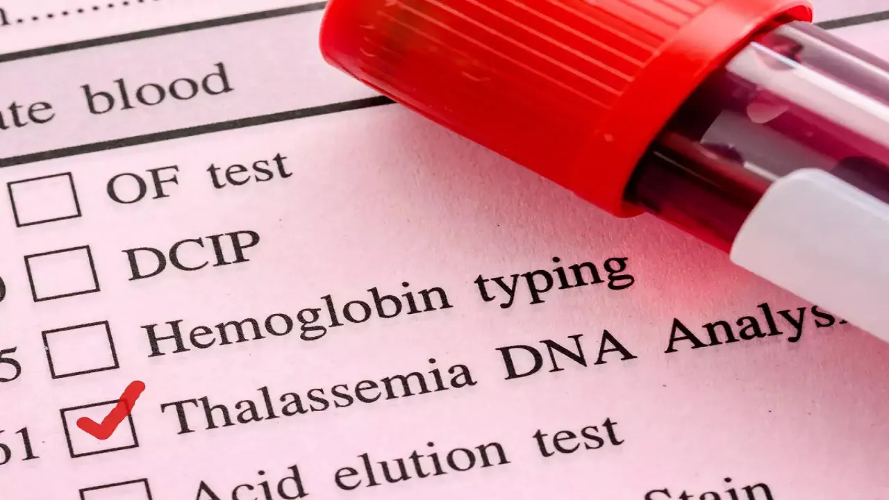 symptoms of thalassemia