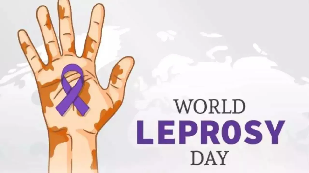 World Leprosy Day