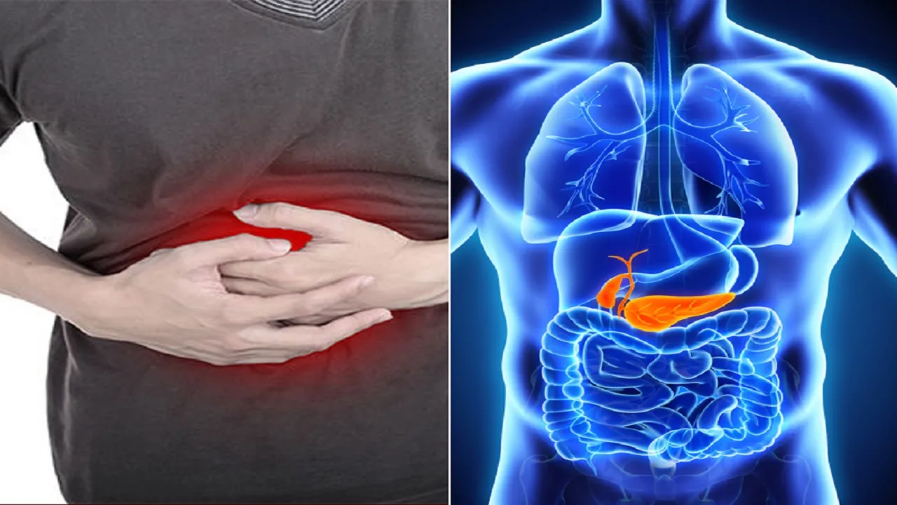 Pancreas Cancer