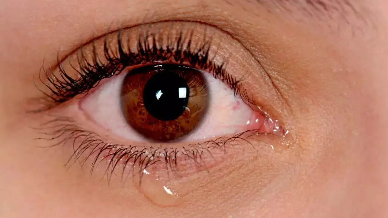 why do eyes water