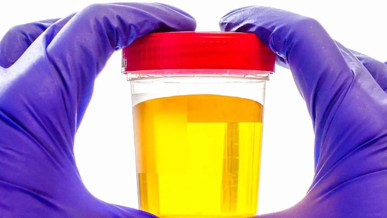 Why is urine yellow