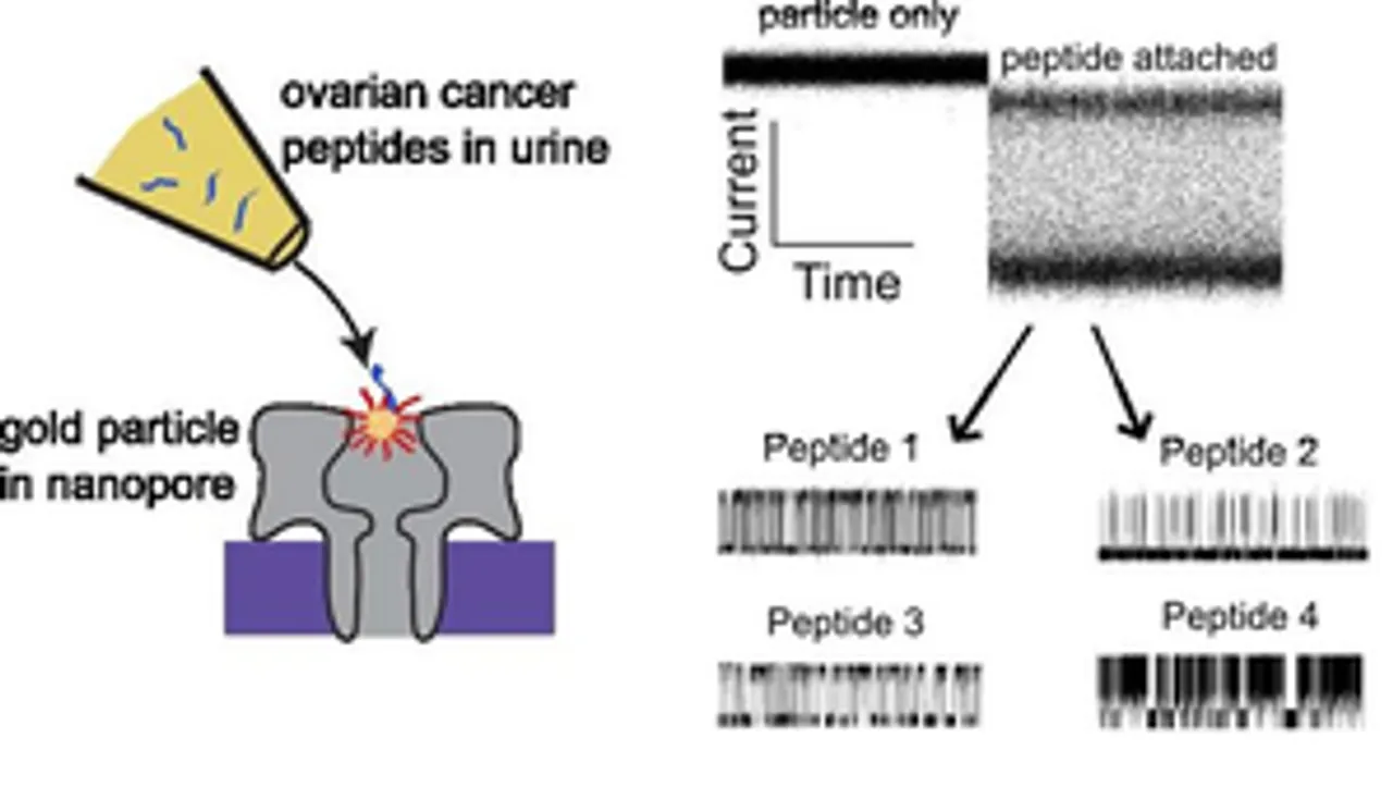 hindi-new-method-may-detect-early-ovarian-cancer-from-urine--20240210174336-20240210180848