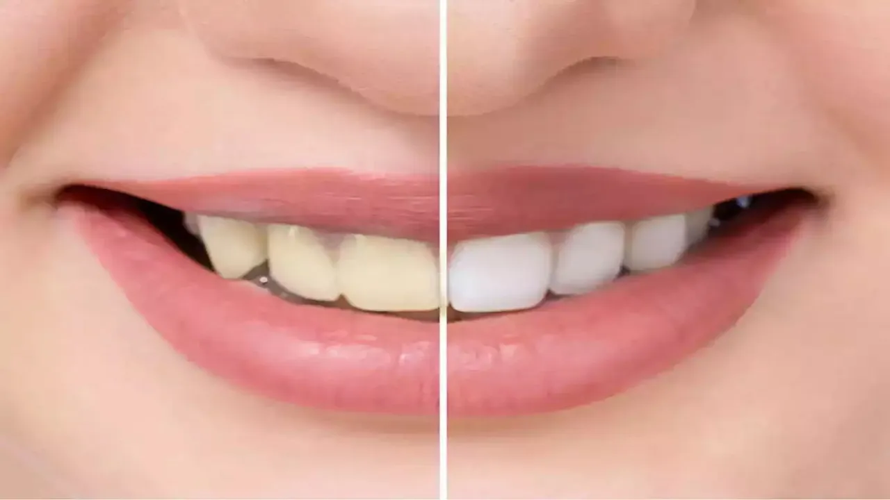 Dental Health