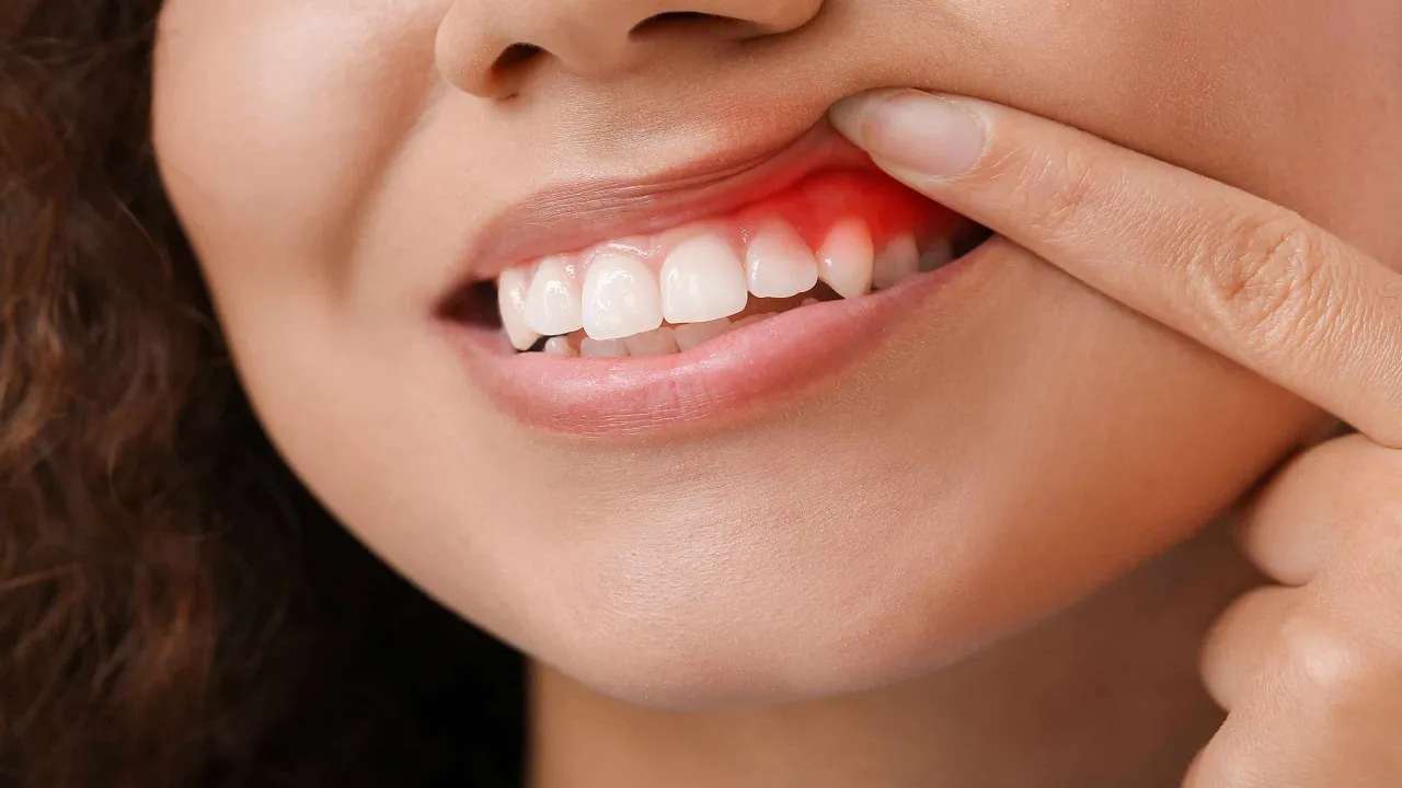 Tooth Care