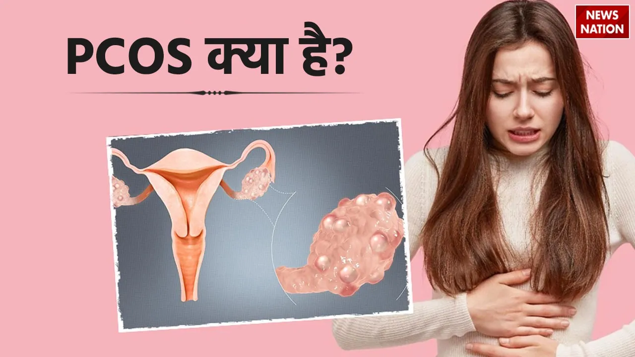Polycystic Ovary Syndrome