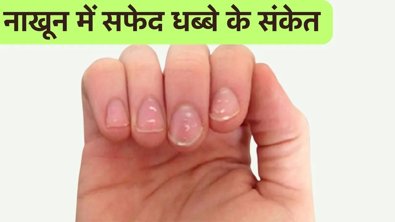 Astro Tips For white spots on nails