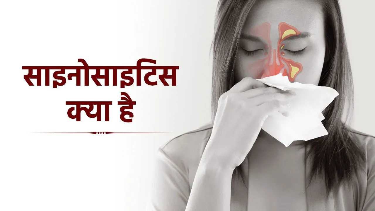 sinusitis